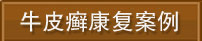 郑州市银屑病研究所